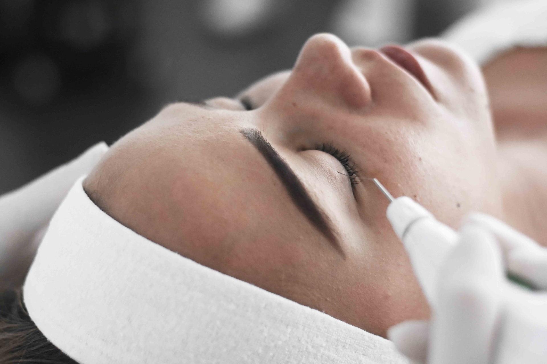 plexr-neablativna-blefaroplastika